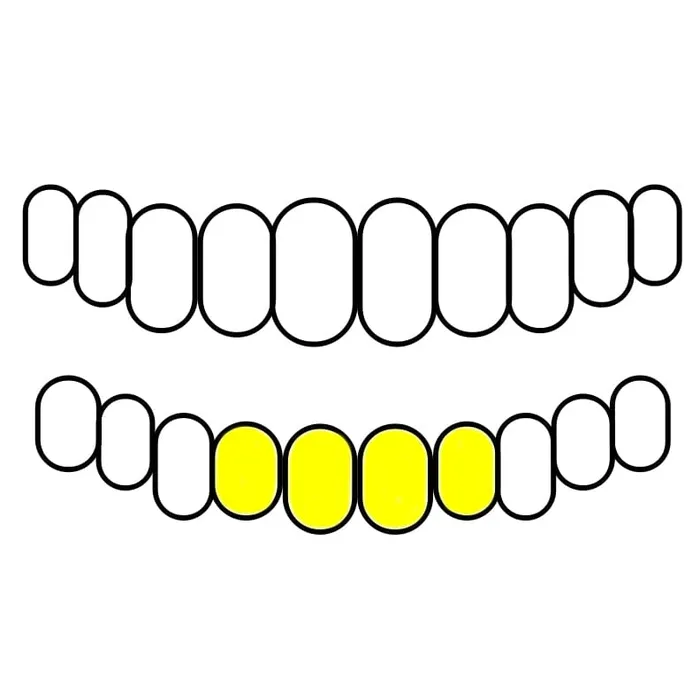 Bling Cartel Admin Rings Gold Plated over 925 Silver Diamond CutDust Open Custom Grillz